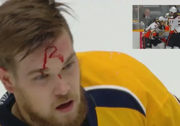 Nechutný zákrok u mantinelu! Ritchie se soupeři krvavě „podepsal“ na čelo