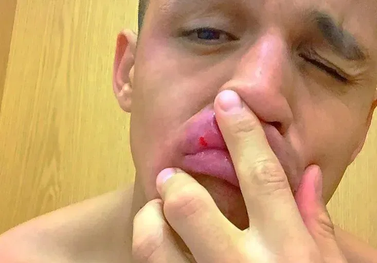 Alexis Sánchez je za šaška! Ufňukánka zesměšnila hvězda Leicesteru