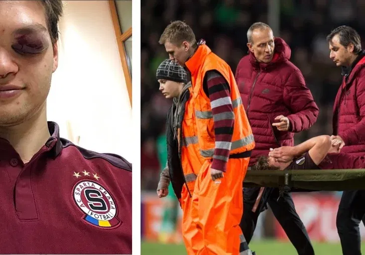 Krvavá lázeň na Letné: Sparťan Pulkrab vypadal po duelu s Rostovem jako boxer!