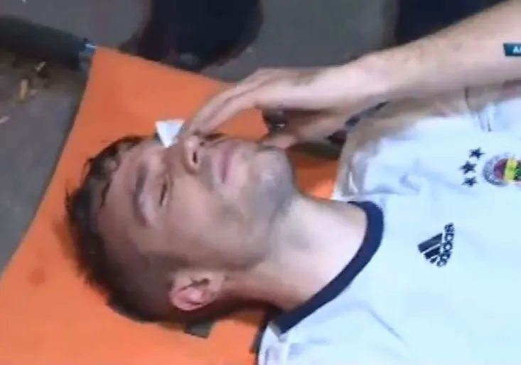 Hrůzné zranění! Van Persie krvácel z oka! Proč musel dlouho čekat na sanitku?