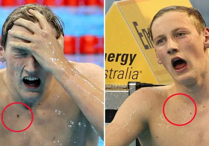 Neskutečná story! Zlatého medailistu zachránil od rakoviny pozorný fanoušek! Co našel na vítězné fotce?