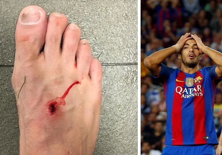 Filipe Luis ukázal krvavé zranění! Jak hystericky reagoval Suárez?