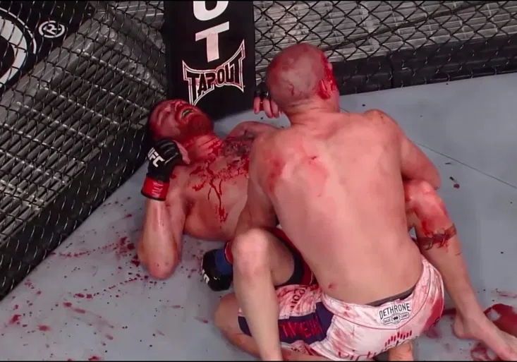 RESPEKT! Z obou tekla KREV! Přitom si přátelsky povídali! Neuvěřitelný moment z UFC!