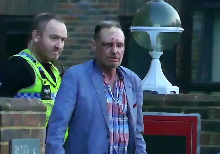 Anglie má strach o legendu! Gascoigne vypadá děsivě. Podívejte se sami