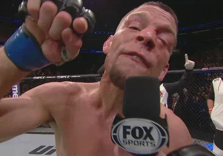 Diaz nemůže s McGregorem vyhrát, byl si jistý komentátor. A tak se musel nechat tetovat!